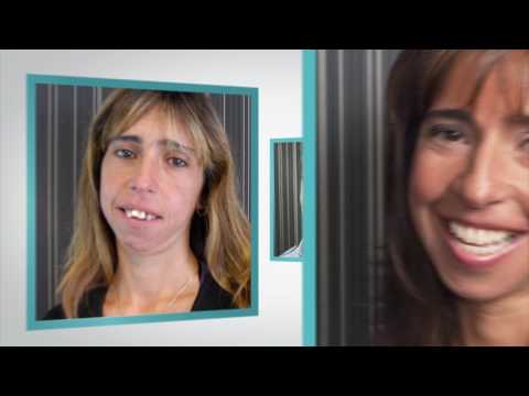 DENTAL GETAWAY MALO ALL ON 4 Dental Implants