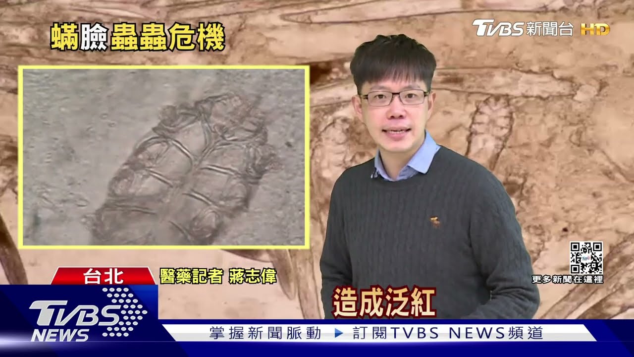 臉部出現「這幾個」症狀 毛囊藏「蠕形蟎蟲」啃皮脂致發炎