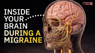 Inside Your Brain During a Migraine