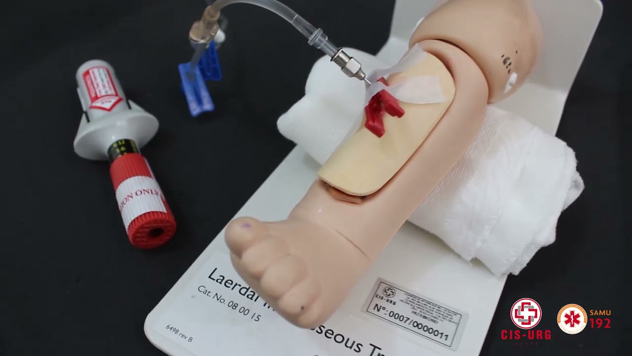 Punção Intraóssea