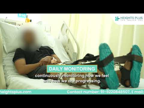 Patient Feedback from Bangalore | After Tibia Lengthening Surgery | Heights Plus