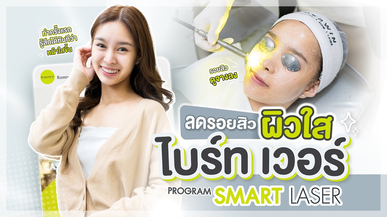 รีวิว Smart Laser ลดรอยสิว รอยดำรอยแดง เพิ่มความชุ่มชื้นผิว
