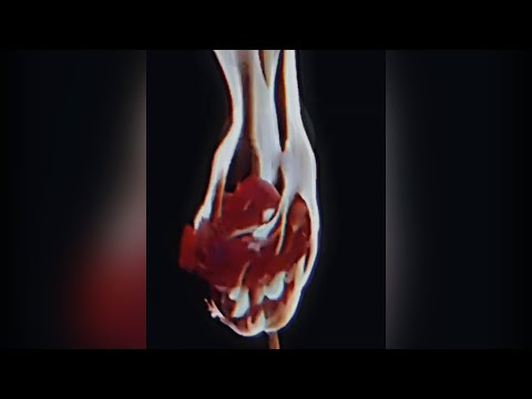 Yemzi X Mxrtalkeems - Goodbyes