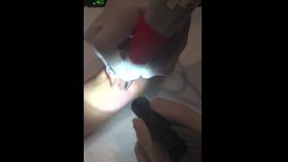 Easy Quick Tattoo Removal