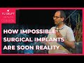 How Impossible Biomedical Implants Are Becoming a Reality