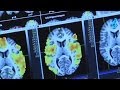 Investigating Drug Abuse: Brain Imaging 