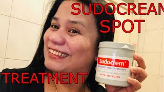 Get rid of spots, acne and blemishes FAST Sudocream Face Mask