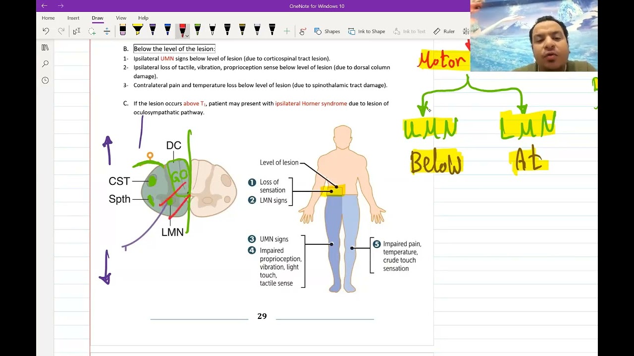 3. Basics of Neuroanatomy for USMLE - (Free trial Link in Description Below)