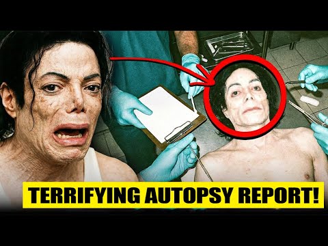 Michael Jackson Autopsy Reveals Horrifying Truth - What Really Happened in His Last 24 Hours
