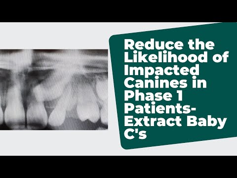 Reduce the Likelihood of Impacted Canines in Phase 1 Patients- extract baby C's