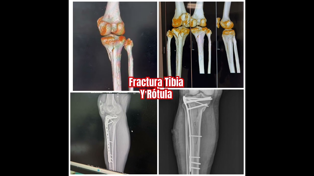 Carlos Tapia Hernández-20