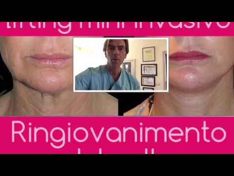 Massaggi facciali efficaci da rughe Faccia che si solleva di Mitino