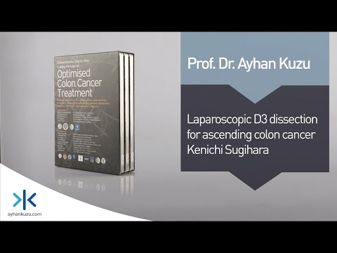 2.3.2. Laparoscopic D3 dissection for Ascending Colon Cancer - Kenichi Sugihara