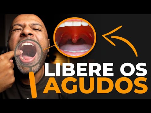 Unleashing your voice in the high notes with power and removing the strain from your throat (soft...