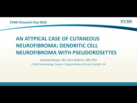 Thumbnail image of video presentation for An Atypical Case of Cutaneous Neurofibroma: Dendritic Cell Neurofibroma with Pseudorosettes