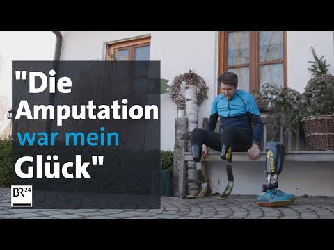 "Meine Amputation hat mir Glück gebracht." | Gut zu wissen | BR24