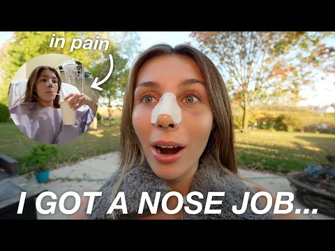 I Got a NOSE JOB and Vlogged The Entire Experience... (Before, After & Recovery Updates!)