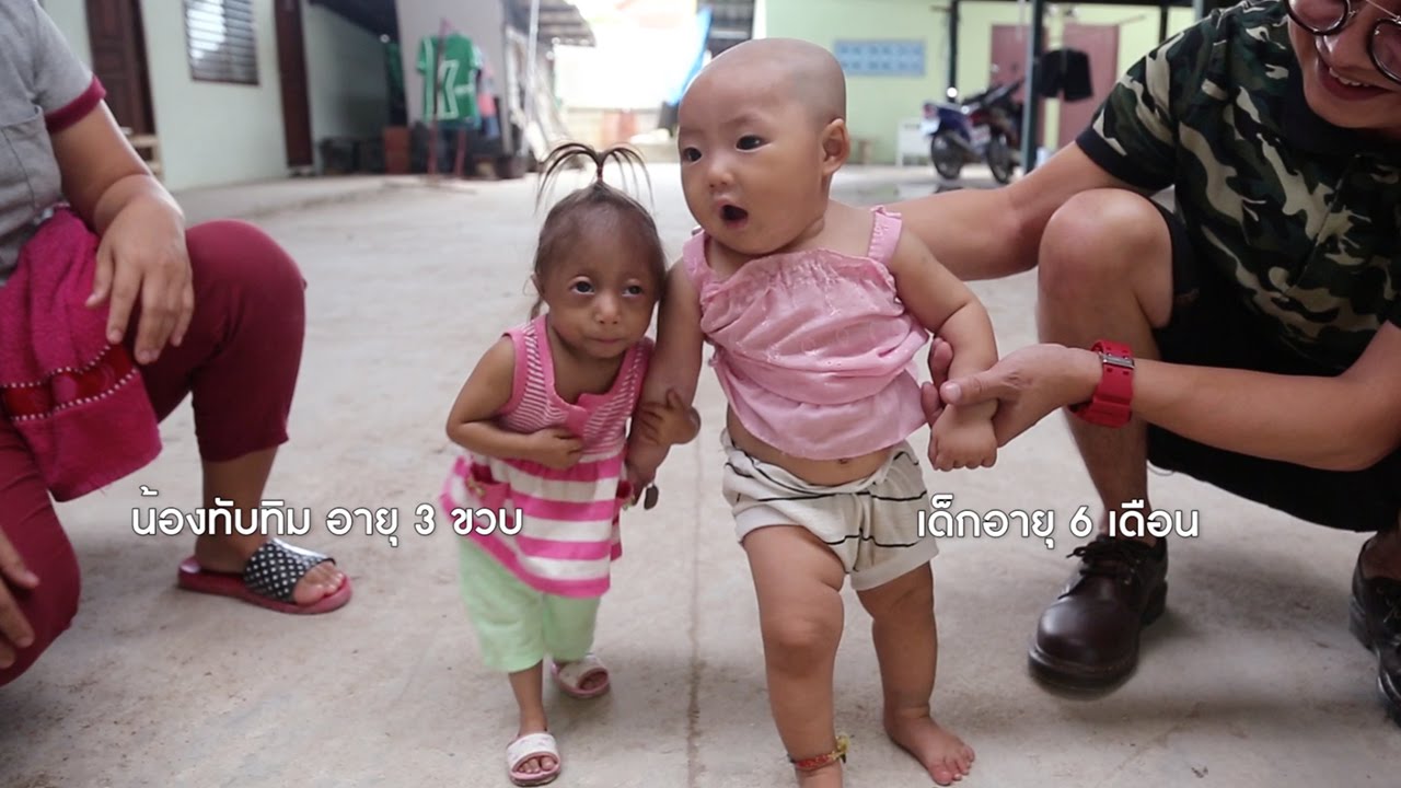 มนุษย์จิ๋ว ตัวเล็กที่สุดในประเทศไทย สูงแค่ 48 ซม.