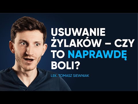 Czy laserowe usuwanie żylaków boli?