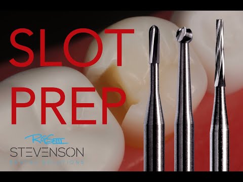 Class II - The Slot Preparation #20 DO Acadental | Dr. Richard Stevenson