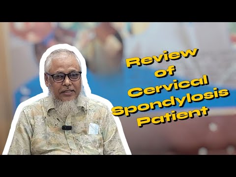 Cervical Spondylosis Patient Review