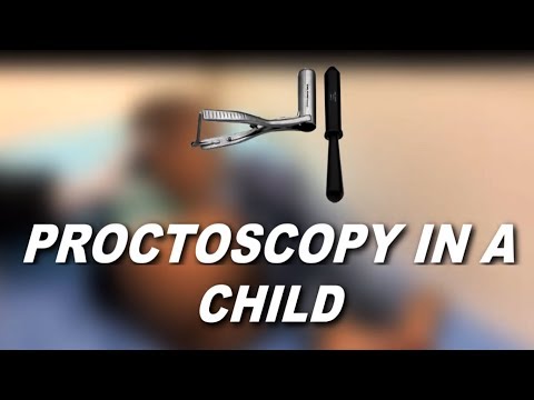 Video proctoscopy in a child for Polyp Prolapse & Constipation.
