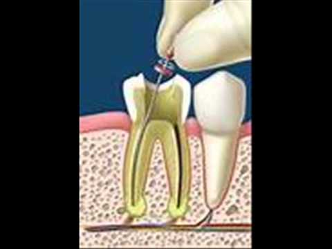 Limas Ultraflex y Sureflex