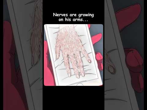 They’re cutting the nerves out of his hand...🩸😱 #anime #shorts