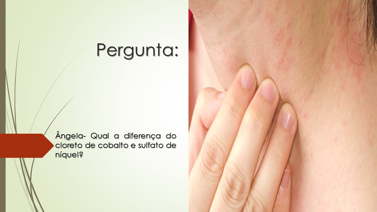 Qual a diferença do cloreto de cobalto e sulfato de níquel