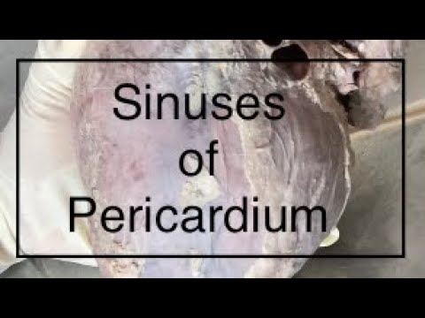 Sinuses of Pericardium Anatomy