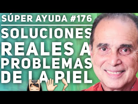 SÚPER AYUDA #176 Soluciones Reales A Problemas De La Piel