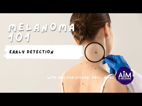 Rilevazione precoce del melanoma