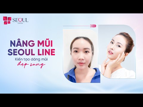 Nâng Mũi Seoul Line, Giải Pháp Hoàn Hảo Để Sở Hữu Dáng Mũi Đẹp