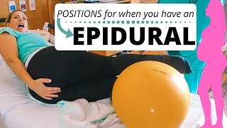 EPIDURAL | positions to speed things up!