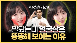 강남 성형외과 원장이 알려주는 “말랐는데 얼굴살은 뚱뚱해 보이는 이유” | 얼굴살, 얼굴형, 얼굴크기