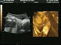 Baby's Ultrasound: