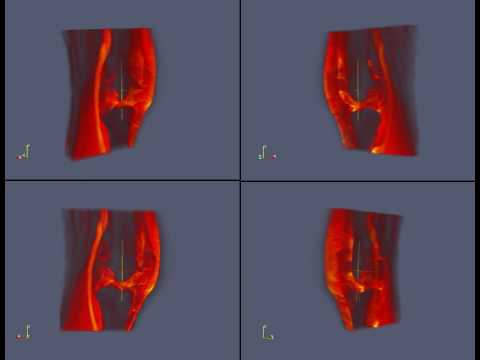 DCE MRI Knee paraview