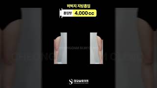 원래 얇았던 것 처럼 허벅지 지흡 전후