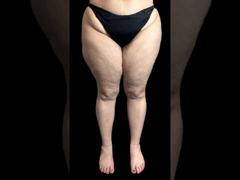 Luisella Troyer-455