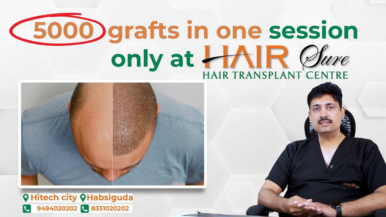 Regrow Your Hair with Dr. Ravi Chander Rao | Best Hair Transplant Surgeon at Hair Sure