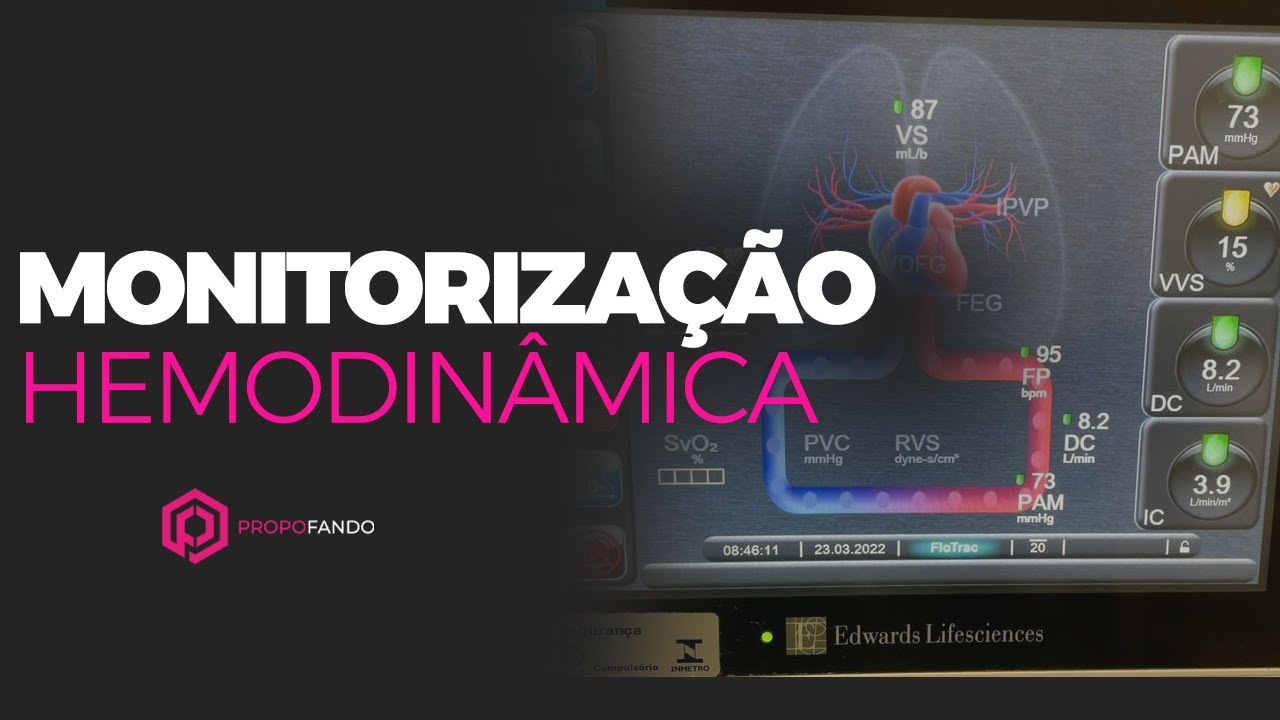 Monitorização hemodinâmica - Tudo que você anestesista precisa saber!