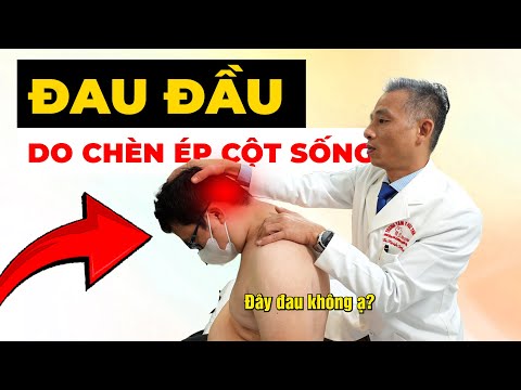 Đau Nửa Đầu Dữ Dội Không Uống Thuốc Nào Khỏi? Nguyên Nhân Mà Bạn Không Ngờ!
