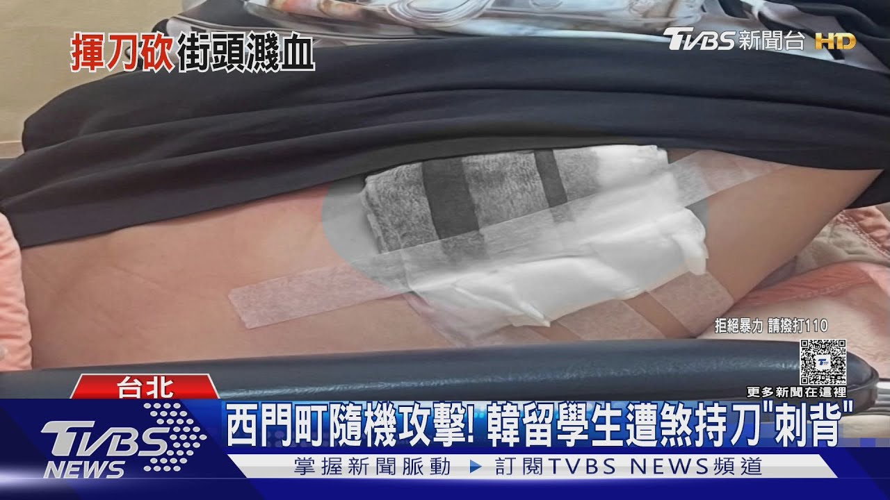 「韓國留學生」西門町遭刺背濺血！發文：我以為台灣治安很好