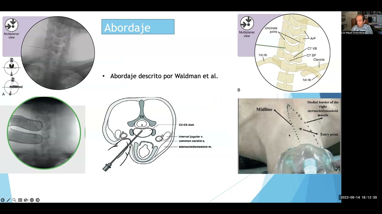 Luis Miguel Torres Morera-3