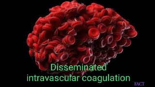 Disseminated intravascular coagulation.