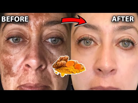 The most powerful ingredient🌹in the world for skin whitening and hyperpigmentation removal