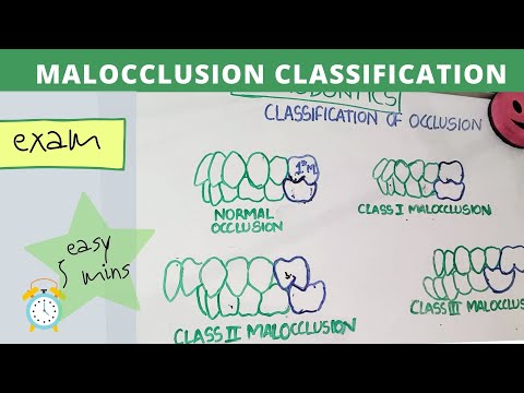 malocclusion of teeth I orthodontics lecture