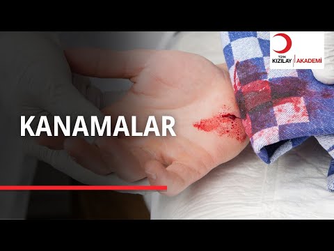 Burnumuz Kanadığı Zaman Ne Yapmalıyız?
