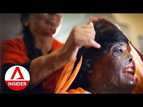 download lagu mp3 mp4 Acid Attack In India, download lagu Acid Attack In India gratis, unduh video klip Acid Attack In India