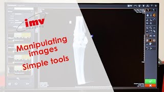Carestream Image Suite: Manipulating images - simple tools - video 2